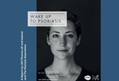 Wake Up to Psoriasis 